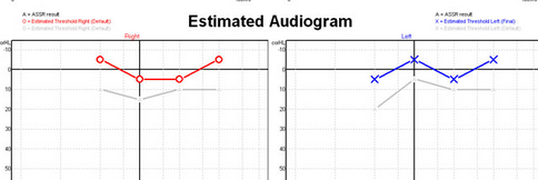 Ocenjen pražni tonski avdiogram