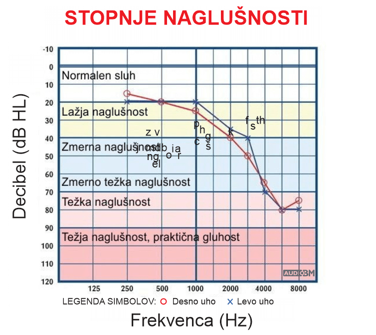 Avdiogram-sluh-prazni-tonski-prikaz-stanja-sluha-stopnje-naglusnosti-avdiometer-audio-bm-slusni-aparati