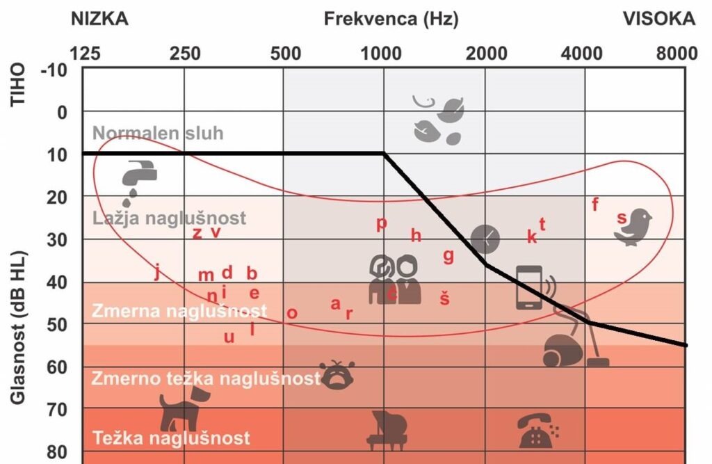 Ce-ne-slisimo-visokih vrekvenc-adg-tonski-avdiogram-audio-bm-svetovanje-slusni-aparati-primer